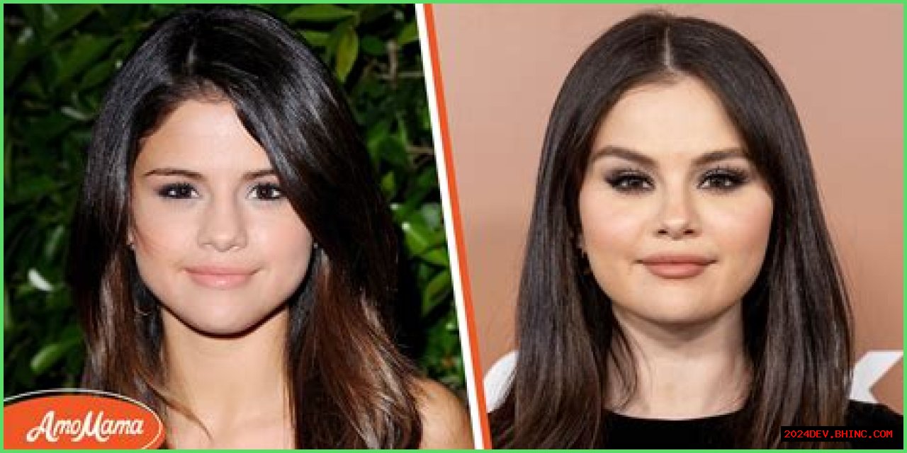 Selena Gomez & Plastic Surgery: Experts Claim She Had Work Done